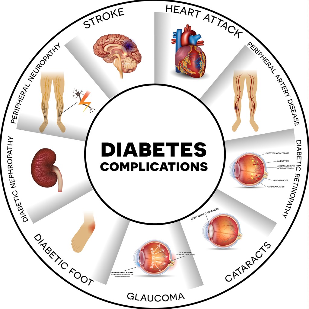 Diabetes conditions